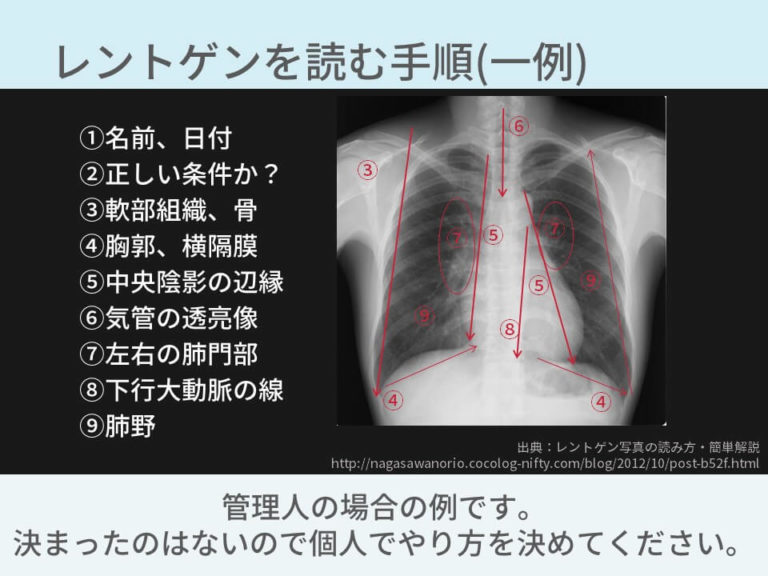 詳しく知りたい人は[ 胸部レントゲンの正しい見方【結論：撮影条件と読む順番が大事】 ]もご覧く …