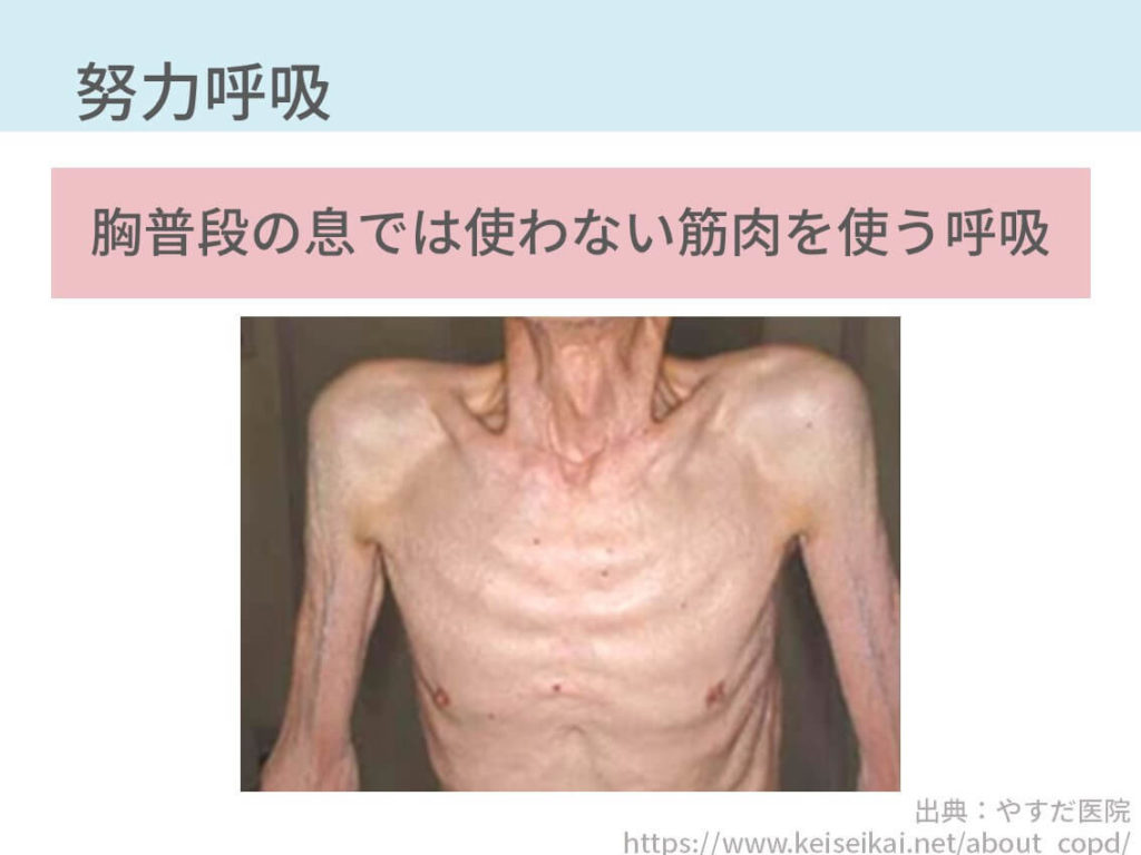 胸部の診察のポイント総まとめ 5つの記事で解説します コキュトレ