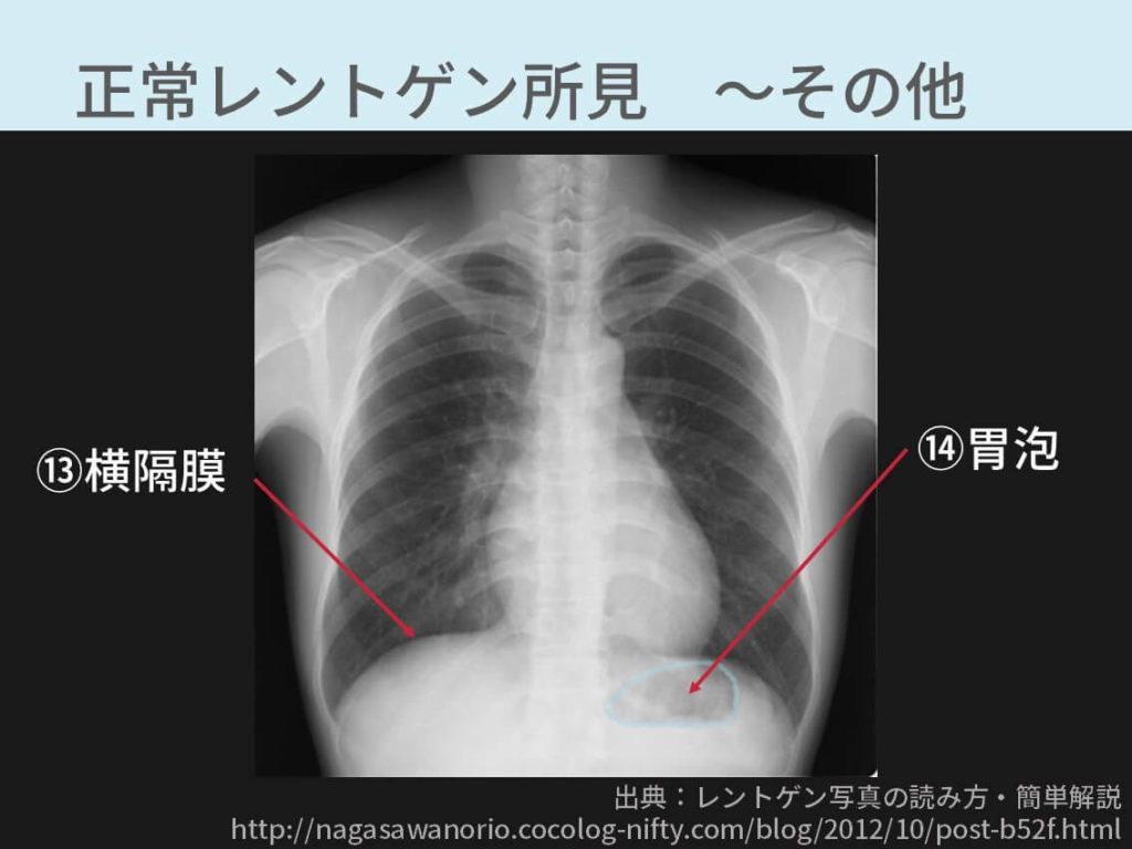 胸部レントゲンのポイント総まとめ 5つの記事で解説 コキュトレ