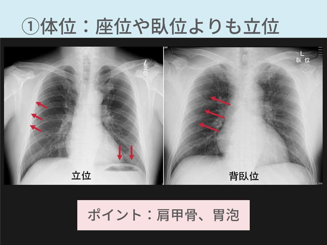 レントデン写真をとる