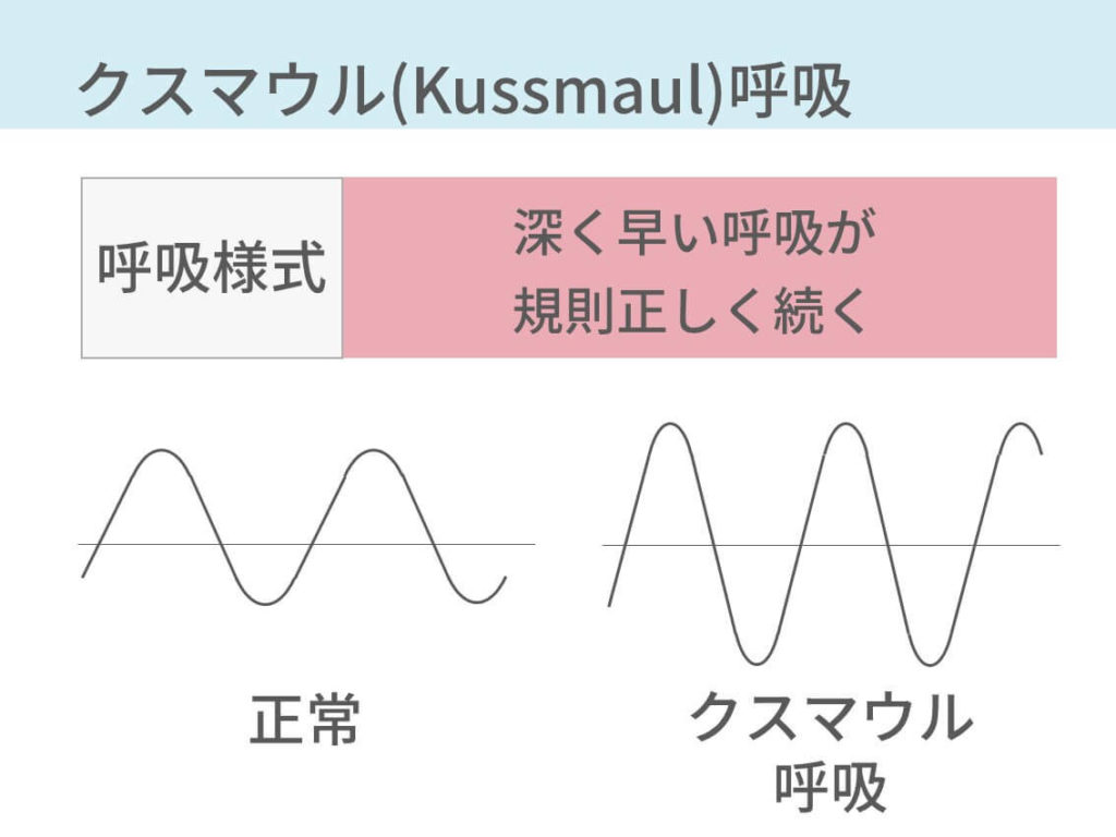 クスマウル呼吸
