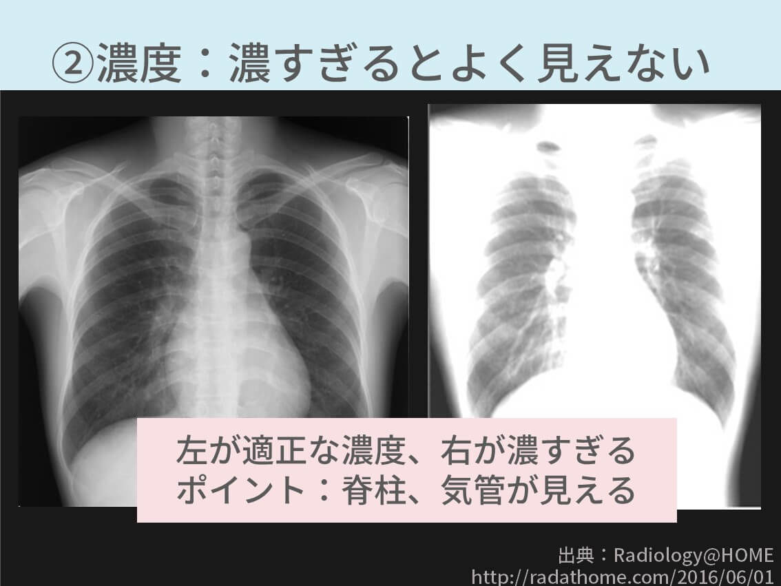 レントデン写真をとる