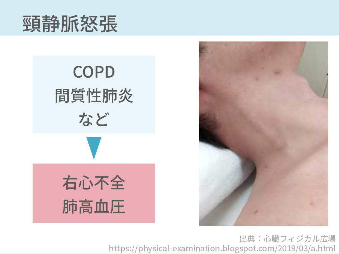 胸部の診察のポイント総まとめ 5つの記事で解説します コキュトレ