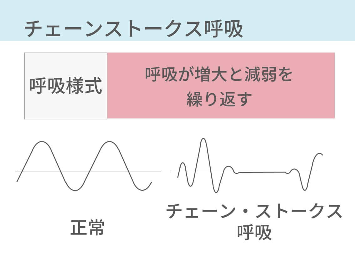 チェーンストークス呼吸を動画つきで解説 クスマウル呼吸 ビオー呼吸 下顎呼吸も コキュトレ