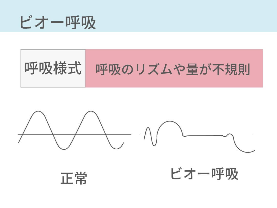 チェーンストークス呼吸を動画つきで解説 クスマウル呼吸 ビオー呼吸 下顎呼吸も コキュトレ