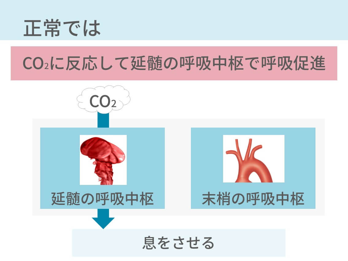 CO2ナルコーシス