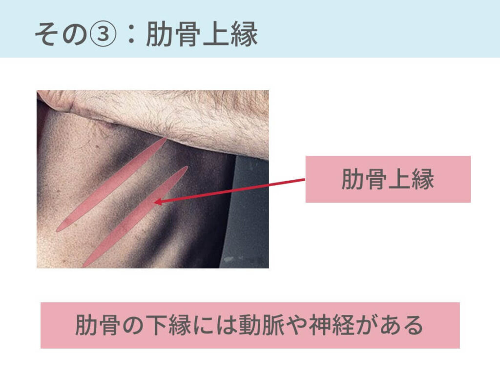 胸腔ドレナージの手技 手順ついて 10年目の呼吸器内科が解説 コキュトレ