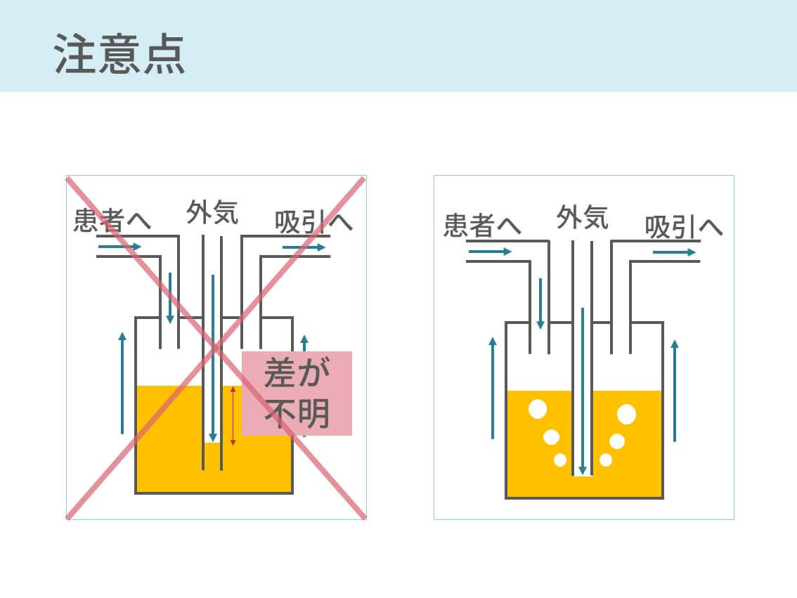 胸腔ドレーンバッグの仕組み 呼吸性移動とエアリークも解説 コキュトレ