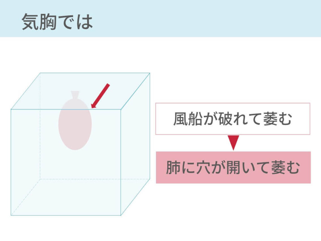 胸腔ドレナージの看護手順 必要物品ついて 10年目の呼吸器内科が解説 コキュトレ