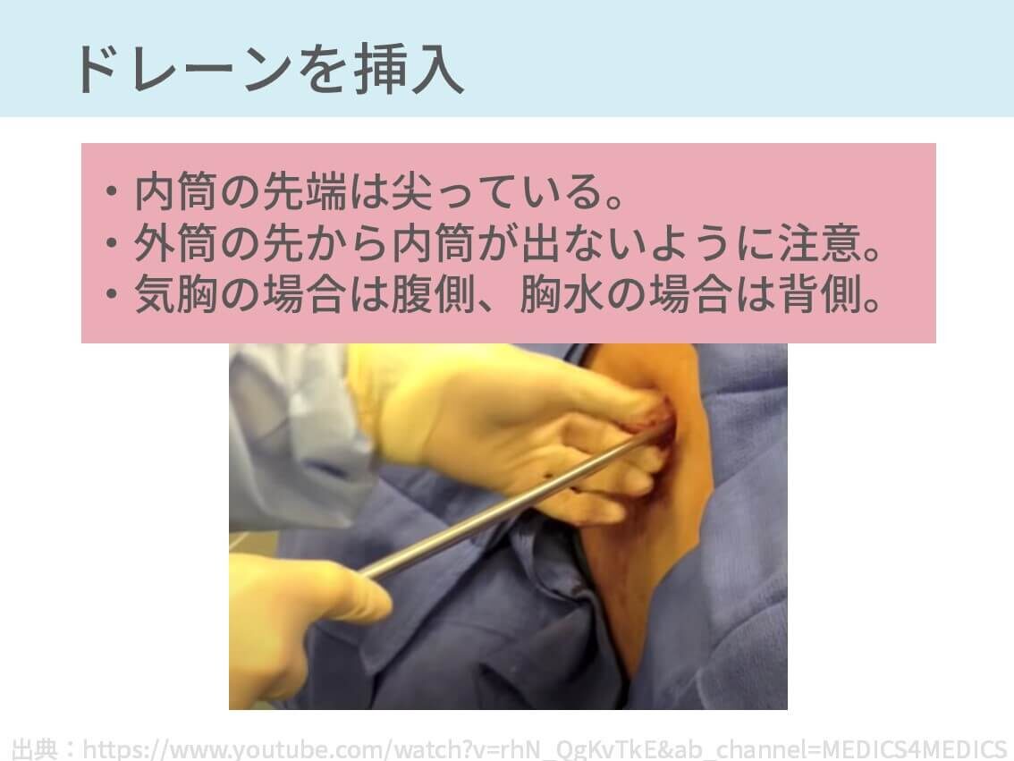 胸腔ドレナージシステムはどのように機能しますか?