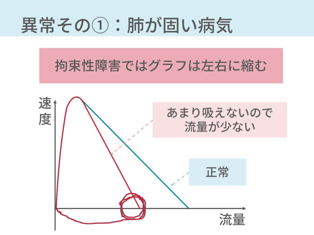 スパイロメトリー検査: 呼気検査を受けるタイミングを知る
