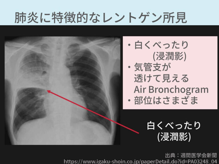 実際の画像もご覧いただきます。