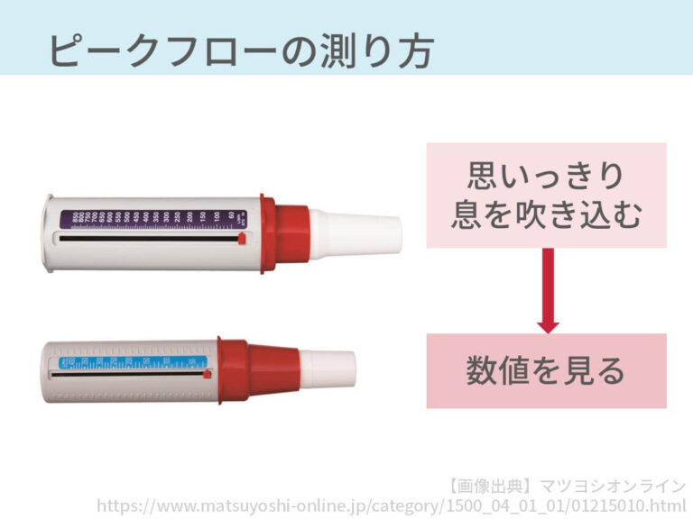肺活量測定が COPD 治療にどのように役立つか