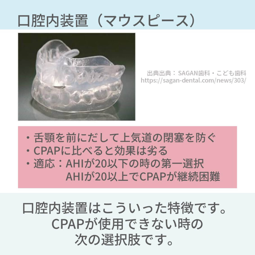睡眠時無呼吸症候群　CPAP　治療　口腔内装置　体位療法　減量療法　手術