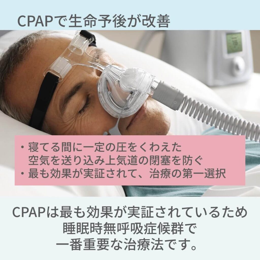 睡眠時無呼吸症候群　CPAP