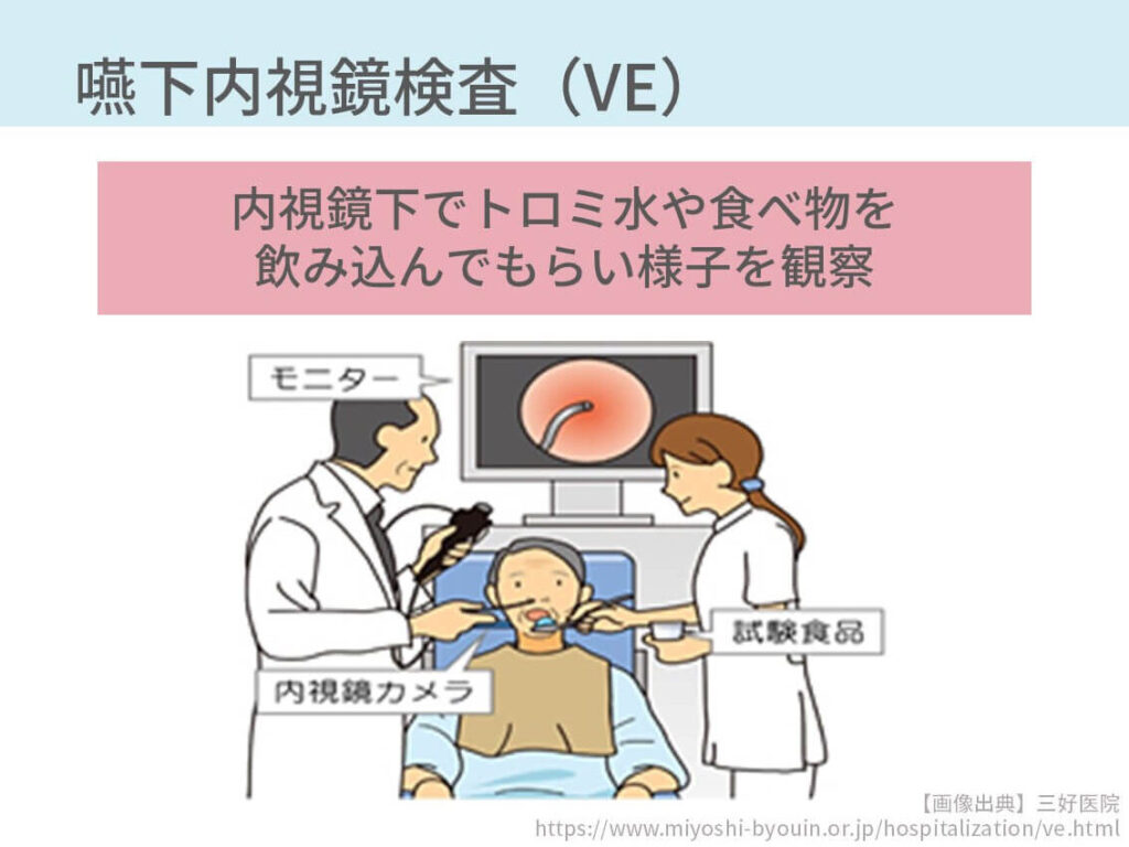 Vorlage: 内視鏡(経鼻ファイバースコープ)を喉に挿入し、トロミ水やゼリー、食べ物を飲み込んでもらい、飲み込みの様子を観察します。 Foto zu 内視鏡(経鼻ファイバースコープ)を喉に挿入し、トロミ水やゼリー、食べ物を飲み込んでもらい、飲み込みの様子を観察します。