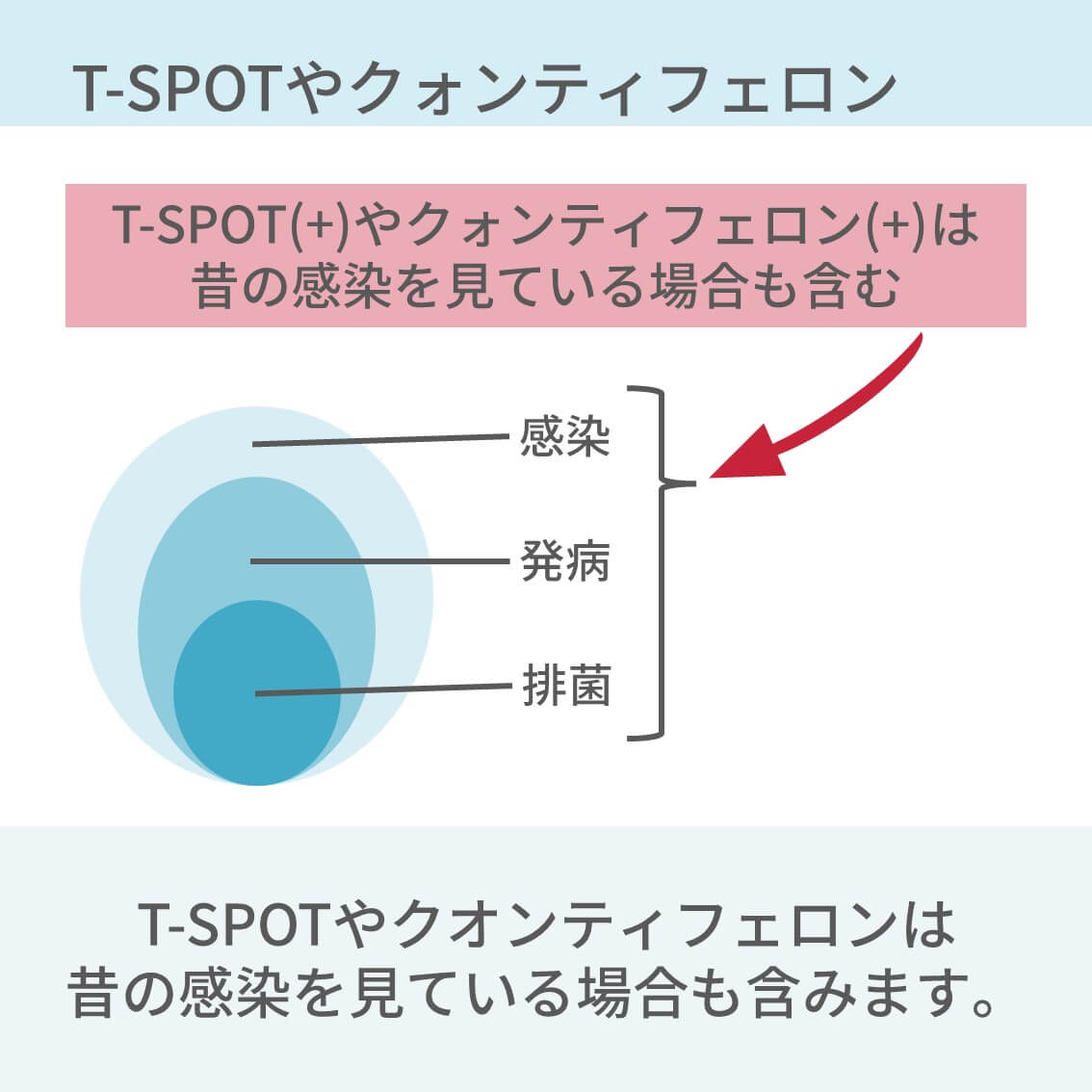 TSPOTやQFTのみでなく、菌が検出されないと「発病」とは見なさなくていいんですね。