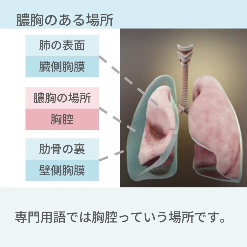 醸膿胸膜とは – 膿胸 画像所見 – OTZF