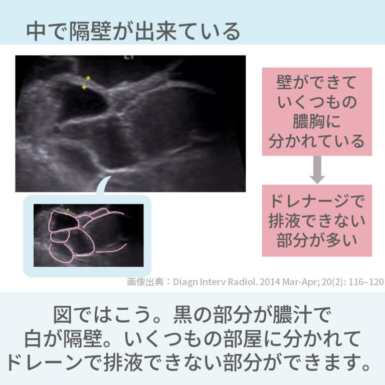 治療の選択