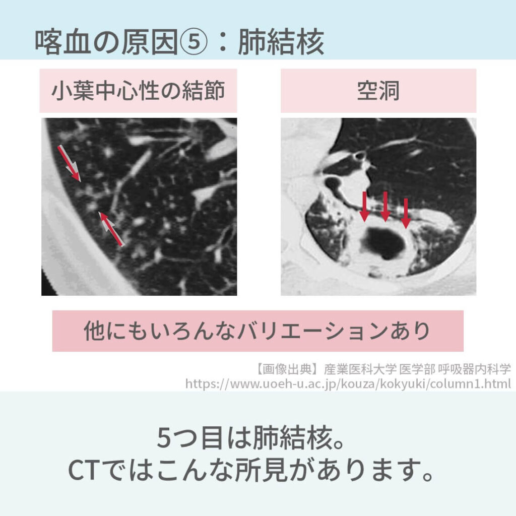 2023年2月13日 (更新日:2023年2月14日)