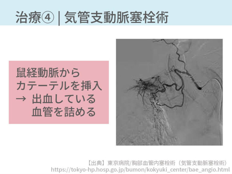 可能なら事前に造影CTを行い、出血している血管を判断させます。